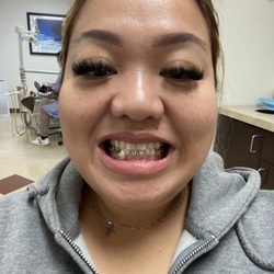Western Dental & Orthodontics - My christmas colored braces