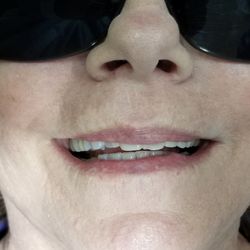 Stephen T Stein, DDS - What can be done?