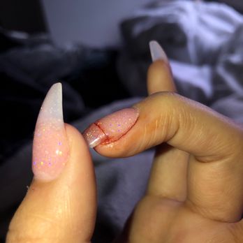 Castle Nail Bar - The broken ring finger. - Nail Salons Near Me - Bellevue, Washington Castle Nail Bar - The broken ring finger. - Nail Salons Near Me - Bellevue, Washington