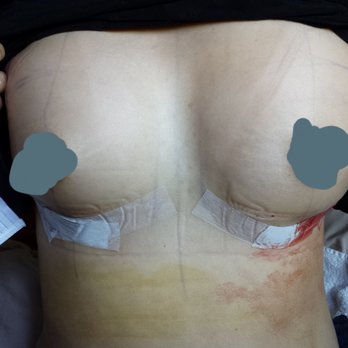 Scott Sattler MD, FACS - Cosmetic Surgeons Near Me - Seattle, Washington
