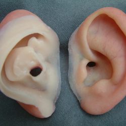 Medical Art Prosthetics - Ear prosthesis