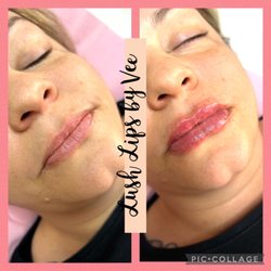 Lush Lips And Beauty - 1 mL of HA filler with lidocaine
- first time client