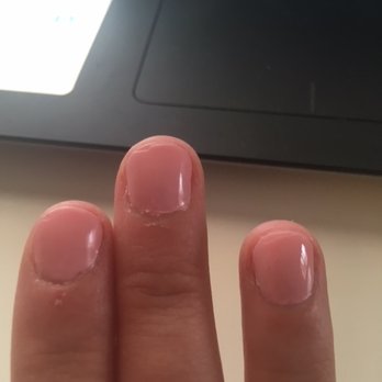 Pink & White Nails - This picture was taken about 10 minutes after my manicure... - Hair Removal Near Me - Denver, Colorado Pink & White Nails - This picture was taken about 10 minutes after my manicure... - Hair Removal Near Me - Denver, Colorado