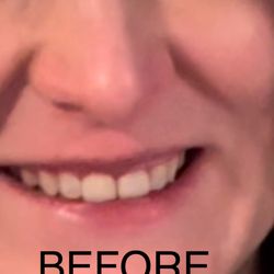 Ascend Dental