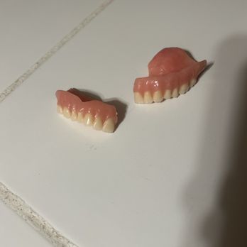Aspen Dental - Bolingbrook, IL - My broken comfilyte dentures - Oral Surgeons Near Me - Bolingbrook, Illinois