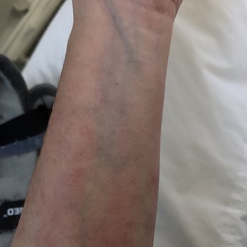 Benjamin P Amis, MD - FLARING MOTTLING and ON FIRE - Orthopedists Near Me - Austin, Texas