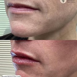Montville Medspa & Pain Center: Donna D'Alessio, MD