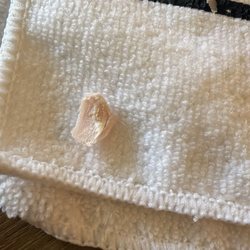 Hannah's Nail Spa - Natural nail ripped off inside of fake nail