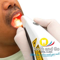 Tooth & Go Dental Clinic - Intraoral Scanning