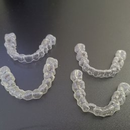 Last set of aligners on top...first set on bottom. Huge difference!