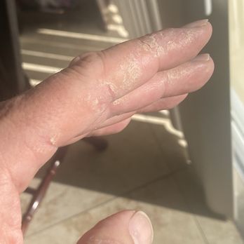 Premier Dermatology - Right hands - Dermatologists Near Me - Alpharetta, Georgia Premier Dermatology - Right hands - Dermatologists Near Me - Alpharetta, Georgia