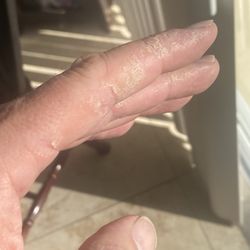 Premier Dermatology - Right hands