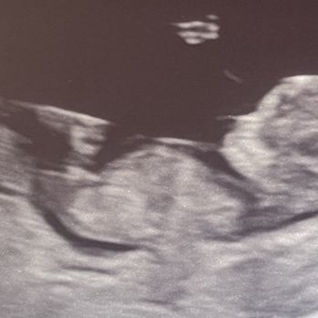 Unique Ultrasound - Diagnostic Imaging Near Me - Temecula, California