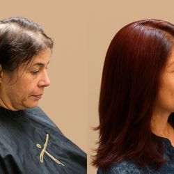 Thursday's Hair Solutions - Hair Replacement for Women Before & After