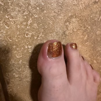 The Nail Bar - Infected nail bed following pedicure, I've had many many pedicures in the last 10 years and this has never happened - Nail Salons Near Me - The Colony, Texas The Nail Bar - Infected nail bed following pedicure, I've had many many pedicures in the last 10 years and this has never happened - Nail Salons Near Me - The Colony, Texas