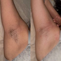 Sugar By Char - Underarm Sugar
