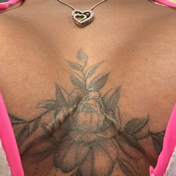 Las Vegas Body Sculpting - Breast lift incisions started from the inside of my chest all the way to my rib cage. A breast lift scar should be only under the boob. - Medical Spas Near Me - Henderson, Nevada