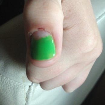 Orchid Spa - Thumb bleeding and a totally destroyed paint job...two hours after a manicure. - Nail Salons Near Me - Kennewick, Washington
