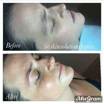 Skin Solutions by Jess - Skin Care Near Me - Worthington , Ohio Skin Solutions by Jess - Skin Care Near Me - Worthington , Ohio
