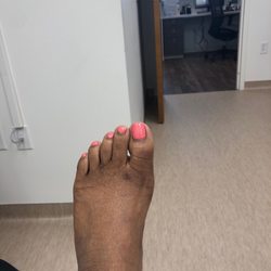 Northwest Surgery Center - Littleton - Oh what beautiful feet you have!