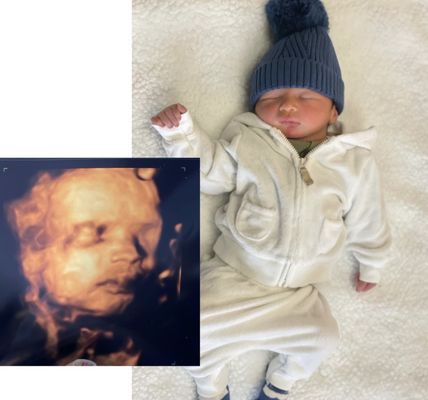 Beautiful Beginnings 3D Imaging