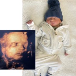Beautiful Beginnings 3D Imaging - We did not get a great photo since his umbilical cord was in front of his face but got a quick glimpse at our baby.