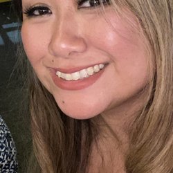 Markham Orthodontics - Me finally smiling with my teeth