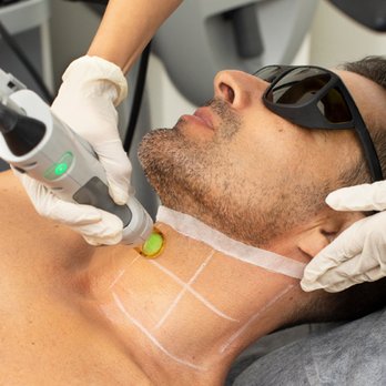 Laser & So - Laser Hair Removal Full - Medical Spas Near Me - New York, New York