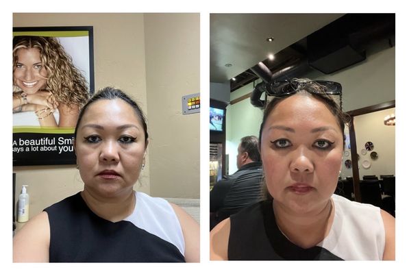 Beverly Hills Rejuvenation Center Southlake Tx BEVERLY HILLS REJUVENATION CENTER - Updated July 2025 - 10 Photos & 60