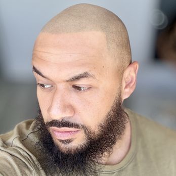Hybrid Ink - Hair Loss Centers Near Me - Castro Valley, California Hybrid Ink - Hair Loss Centers Near Me - Castro Valley, California