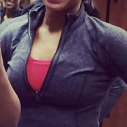 My before photo before I started working on my skin my forehead was full of cystic acne nodules