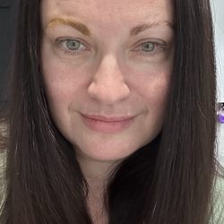 Jack Tian, MD - ICL Surgery on my right eye by amazing doctor Jack Tian