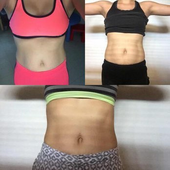Be Healthy SPA - Masaje reductivos - Physical Therapy Near Me