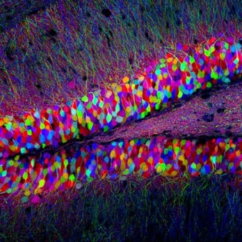 Adams Chiropractic Offices - Brainbow!!! - Sports Medicine Near Me - Sonoma, California Adams Chiropractic Offices - Brainbow!!! - Sports Medicine Near Me - Sonoma, California