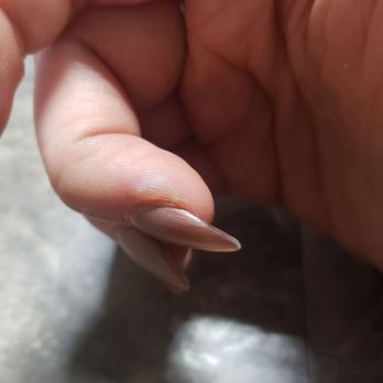 Maiden Nails & Spa - Puss filled blisters on both sides of finger from unsanitary tools used. Blue sanitizer is for decoration, apparently - Nail Salons Near Me - Victor, New York Maiden Nails & Spa - Puss filled blisters on both sides of finger from unsanitary tools used. Blue sanitizer is for decoration, apparently - Nail Salons Near Me - Victor, New York