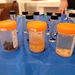 Vancouver Police Museum & Archives - Different sized maggots