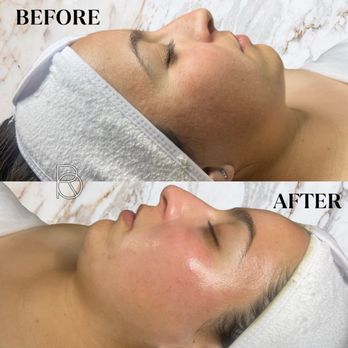 Refined Beauty Aesthetics - Estheticians Near Me - Escondido, California Refined Beauty Aesthetics - Estheticians Near Me - Escondido, California