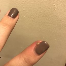 Infection on finger after manicure with dirty instruments Infection on finger after manicure with dirty instruments