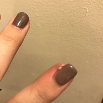 V Nail Spa - Infection on finger after manicure with dirty instruments - Nail Salons Near Me - Los Angeles, California V Nail Spa - Infection on finger after manicure with dirty instruments - Nail Salons Near Me - Los Angeles, California
