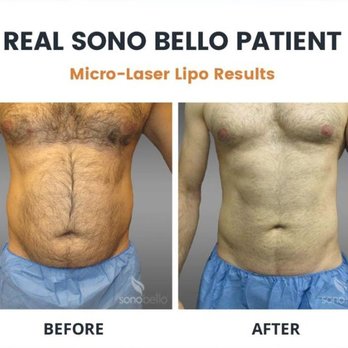 Sono Bello - Cosmetic Surgeons Near Me - San Ramon, California