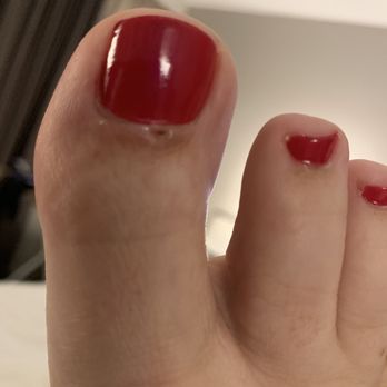 Nail Service & Spa - Bleeding on front of toe. - Nail Salons Near Me - Tucker, Georgia Nail Service & Spa - Bleeding on front of toe. - Nail Salons Near Me - Tucker, Georgia