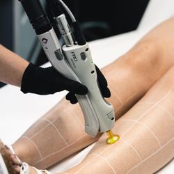 Skin - Laser Hair Removal in Las Vegas | No Contracts