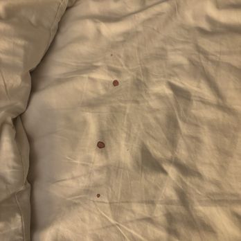 Super 8 by Wyndham Denver Stapleton - Period blood on sheets - Hotels Near Me - Denver, Colorado Super 8 by Wyndham Denver Stapleton - Period blood on sheets - Hotels Near Me - Denver, Colorado