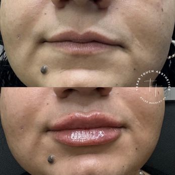Texas Touch Aesthetics - Aestheticians Near Me - Spring, Texas