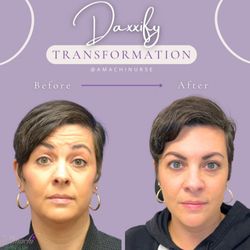 AmaChi MedSpa - After Daxxify treatment at Amachi Medspa