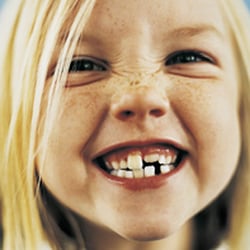 Anderson Pediatric Dentistry