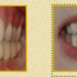Gary B Shenfield, DDS - Before & After