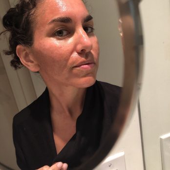Ethereal Skincare - Face and neck were red and burned for 2 days before peeling. Took an ibuprofen for the pain/inflammation. - Skin Care Near Me - La Jolla, California Ethereal Skincare - Face and neck were red and burned for 2 days before peeling. Took an ibuprofen for the pain/inflammation. - Skin Care Near Me - La Jolla, California