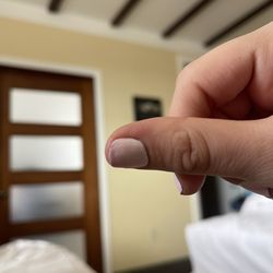 Chipped nails