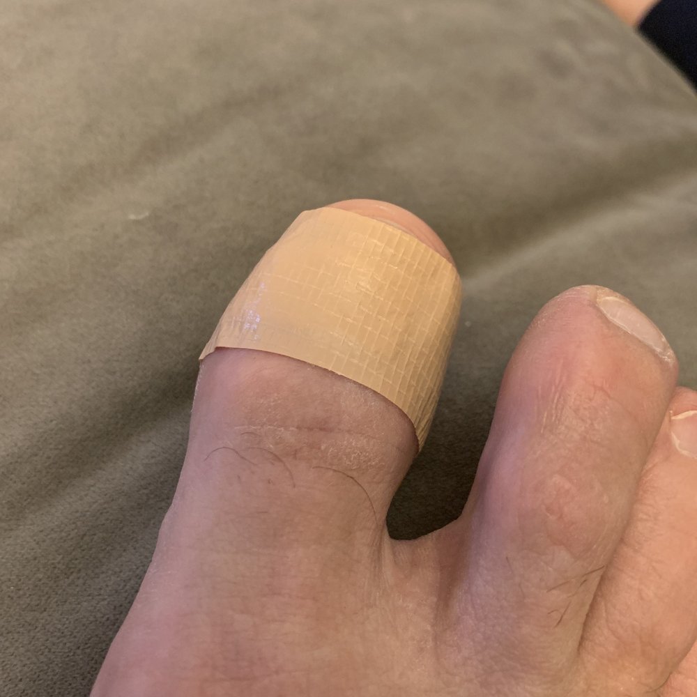 Ouch!!